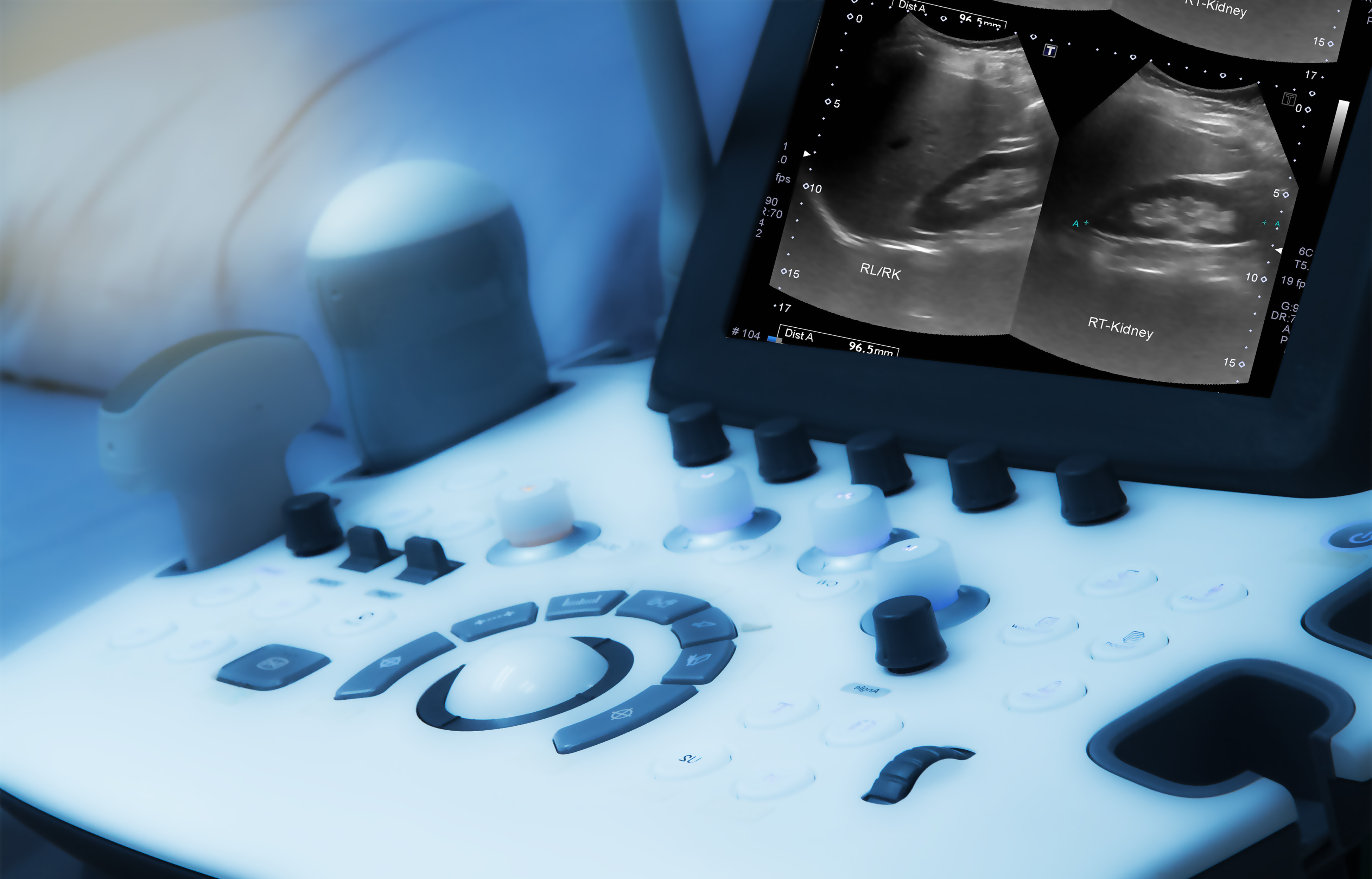 High-resolution diagnostic ultrasound machine at Clearview Imaging